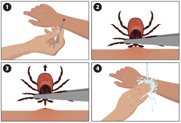як захиститися від кліщів: як витягнути кліща