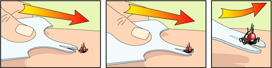 как защититься от клещей: как вытащить клеща с помощью карты